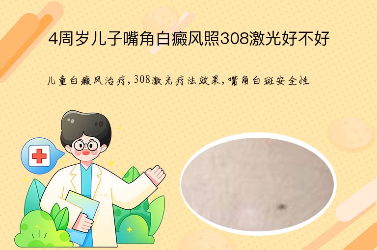 4周岁儿子嘴角白癜风照308激光好不好”