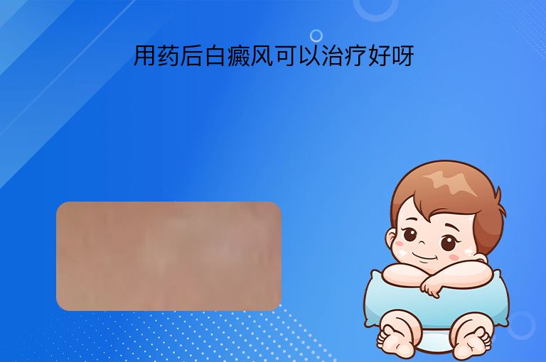 https://www.bdfsjzyy.com/d/file/p/8bea2aa0eebf1b4f2ab67427ce6d2f36.jpeg