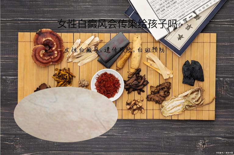 女性白癜风会传染给孩子吗”