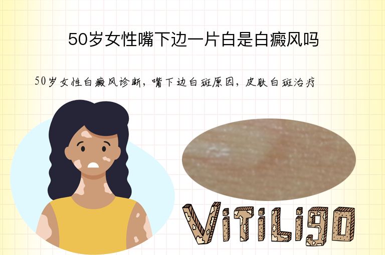 50岁女性嘴下边一片白是白癜风吗”