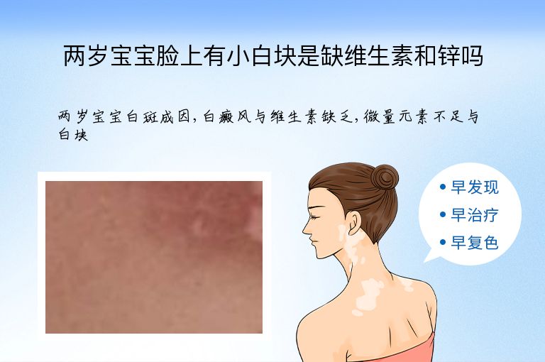 https://www.bdfsjzyy.com/d/file/p/74a1dd655dee5967464c983f17cdd5f8.jpeg