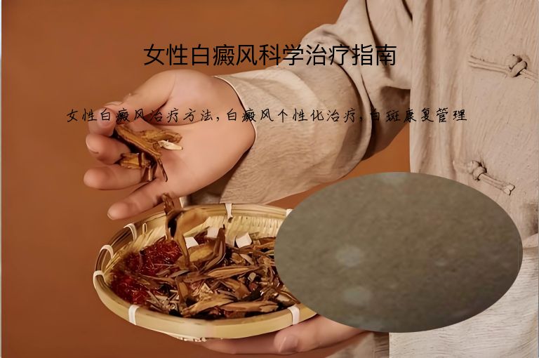 女性白癜风科学治疗指南”