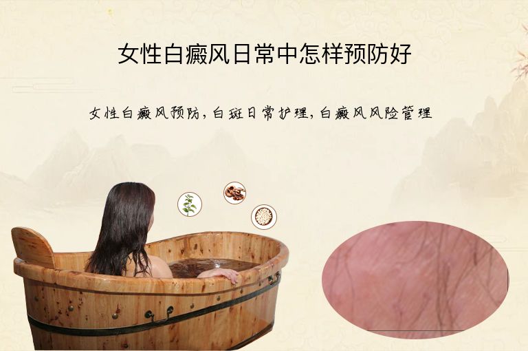 https://www.bdfsjzyy.com/d/file/p/bcc466860124aa54cf72a7bf069e2543.jpeg
