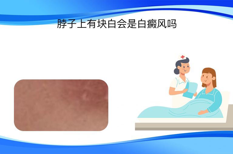 https://www.bdfsjzyy.com/d/file/p/6d15ed95a851fae08fd9bcb0c104e76b.jpeg
