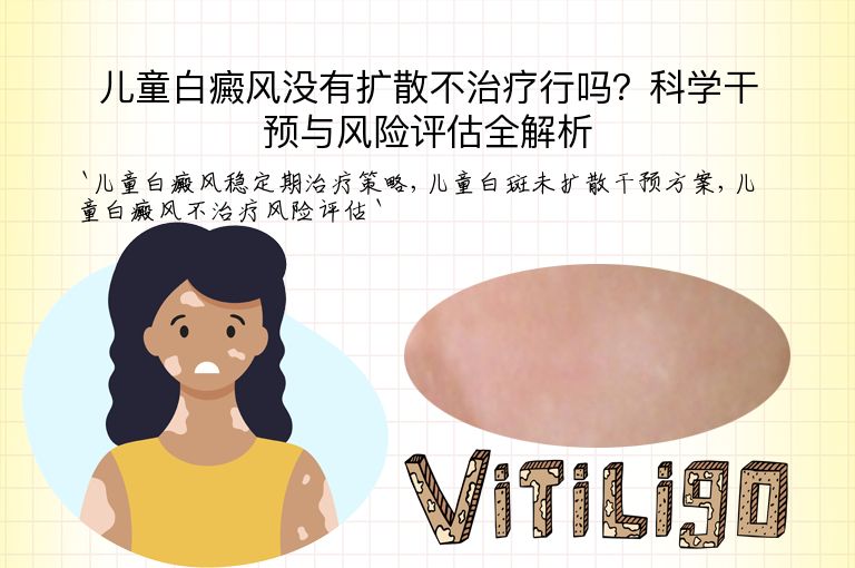 儿童白癜风没有扩散不治疗行吗?科学干预与风险评估全解析