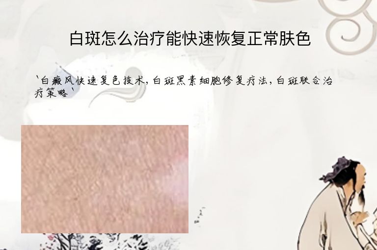 https://www.bdfsjzyy.com/d/file/p/74804f9aa74989b33663b484494857c5.jpeg