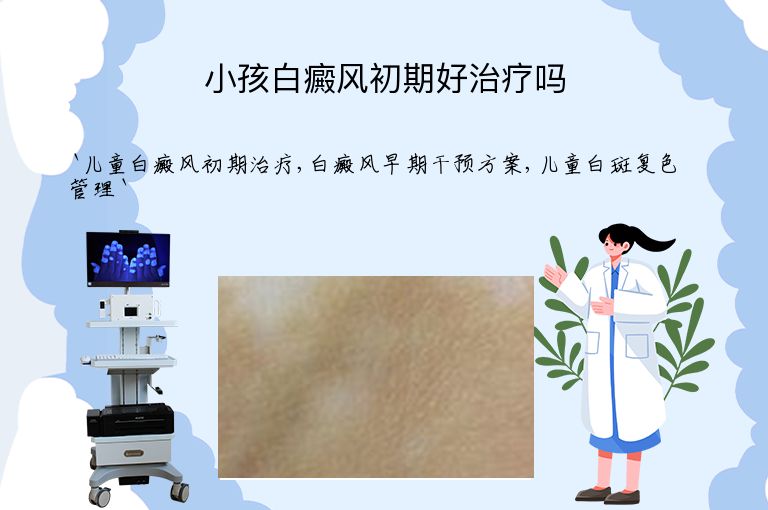 小孩白癜风初期好治疗吗