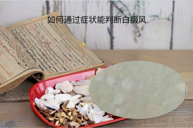 https://www.bdfsjzyy.com/d/file/p/2b89edf5b061320496e057dd5d975d39.jpeg