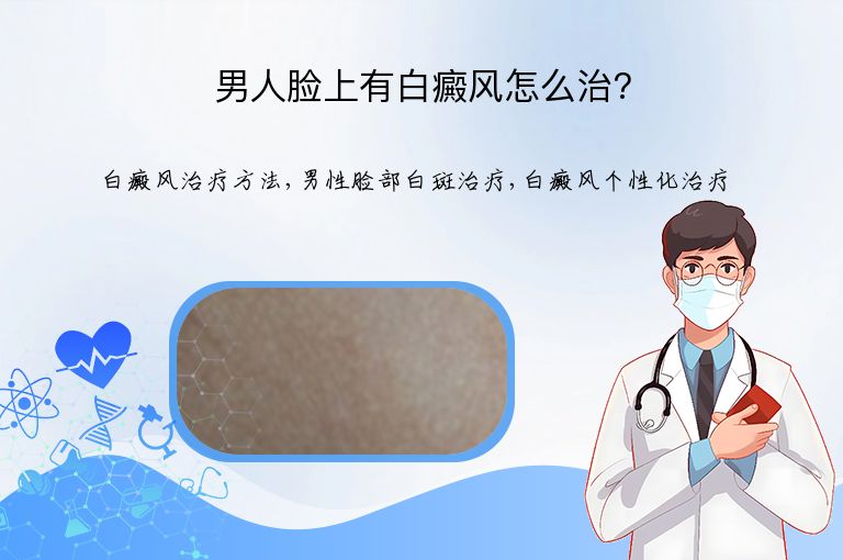 男人脸上有白癜风怎么治?”