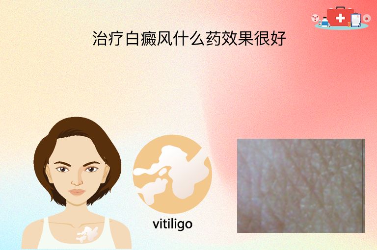 治疗白癜风什么药效果很好”