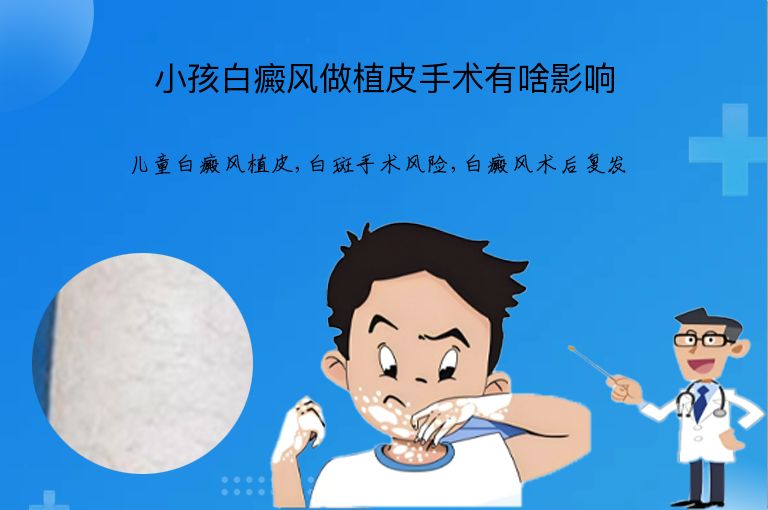 小孩白癜风做植皮手术有啥影响”