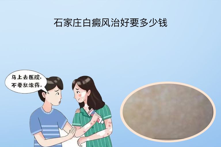 https://www.bdfsjzyy.com/d/file/p/e20c88408c6e65a5eddf7d8bf89c303e.jpeg