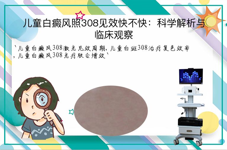 儿童白癜风照308见效快不快:科学解析与临床观察
