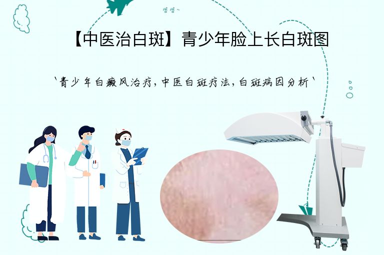 【中医治白斑】青少年脸上长白斑图”