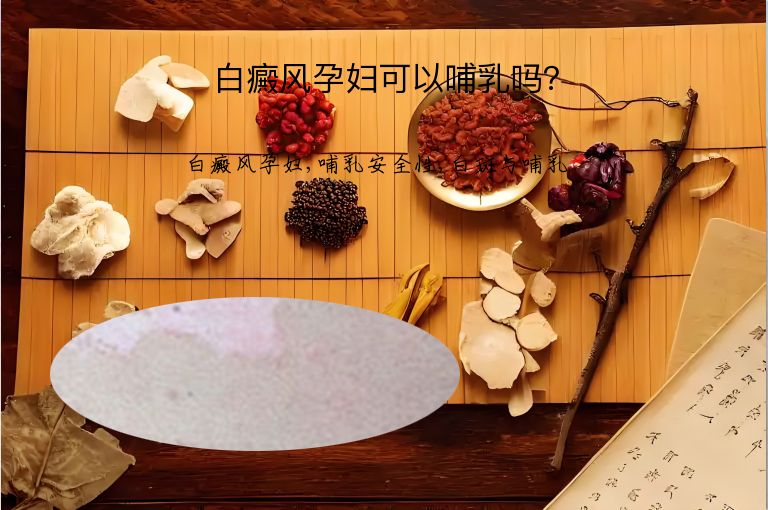 白癜风孕妇可以哺乳吗?”