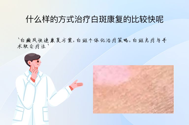什么样的方式治疗白斑康复的比较快呢
