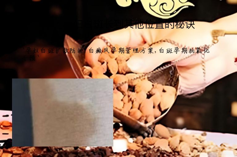 避免孕妇白斑长到其他位置的秘诀