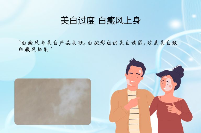 美白过度 白癜风上身”