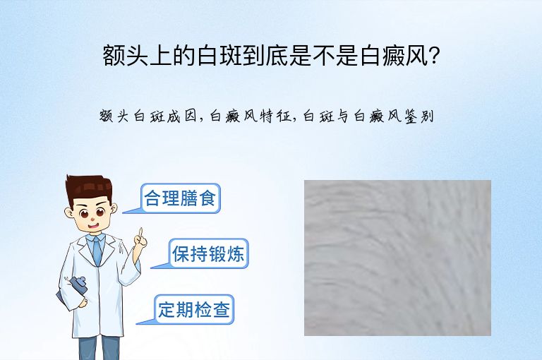 额头上的白斑到底是不是白癜风?”