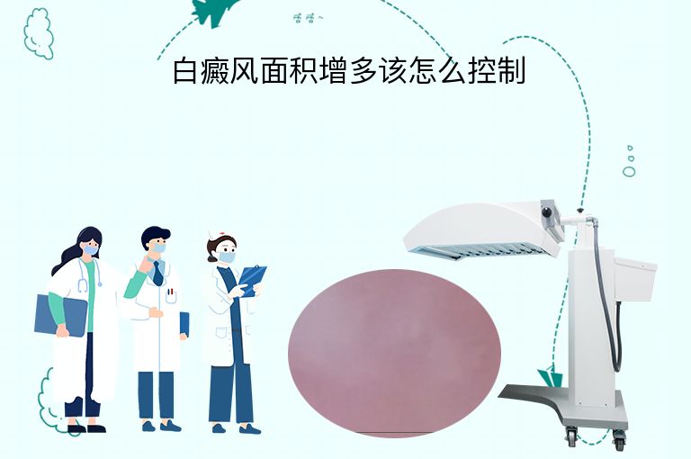 白癜风面积增多该怎么控制”