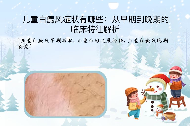 儿童白癜风症状有哪些：从早期到晚期的临床特征解析