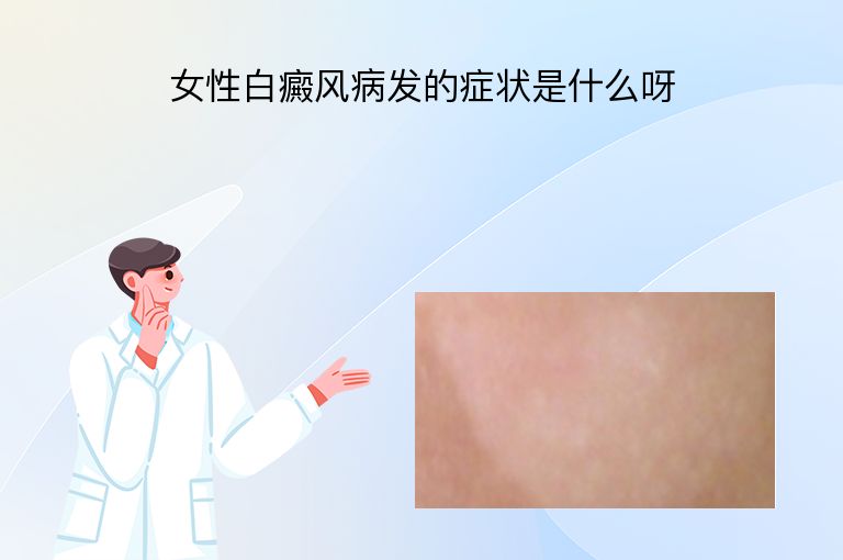 女性白癜风病发的症状是什么呀