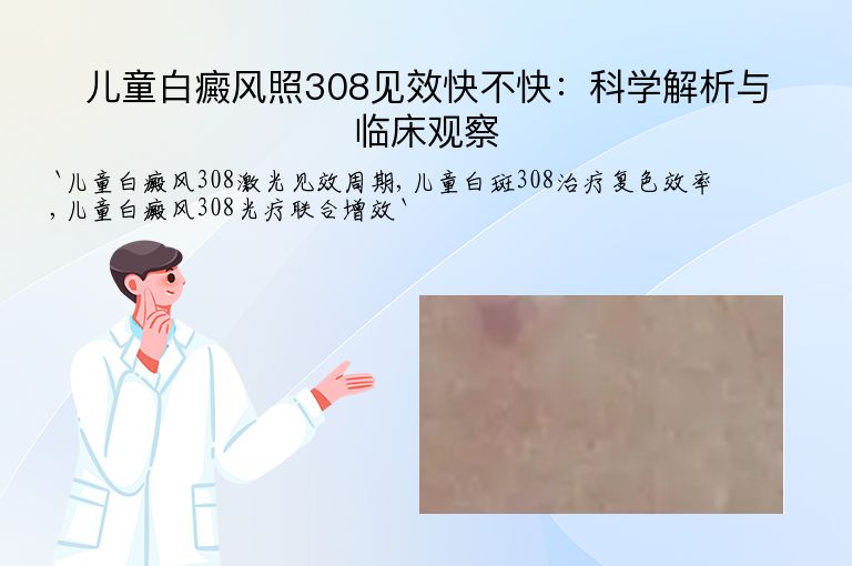 儿童白癜风照308见效快不快:科学解析与临床观察