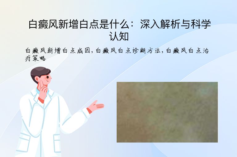 白癜风新增白点是什么:深入解析与科学认知”