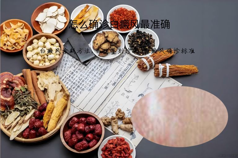 怎么确诊白癜风最准确”