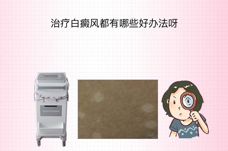 治疗白癜风都有哪些好办法呀”