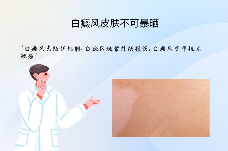 白癜风皮肤不可暴晒