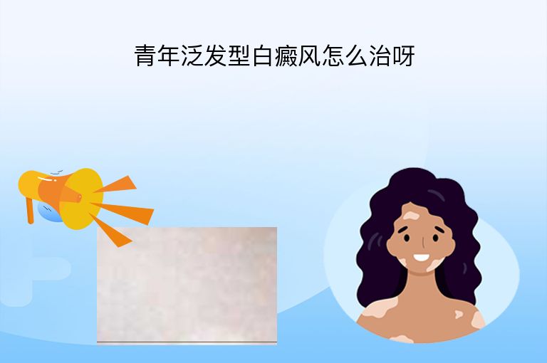 青年泛发型白癜风怎么治呀”