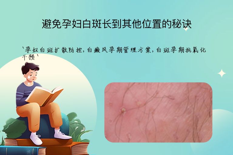 避免孕妇白斑长到其他位置的秘诀