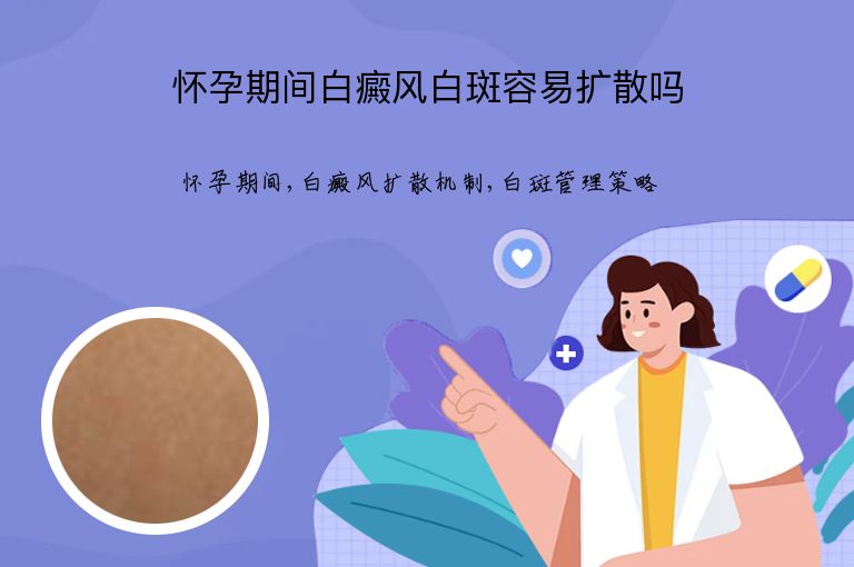 怀孕期间白癜风白斑容易扩散吗”