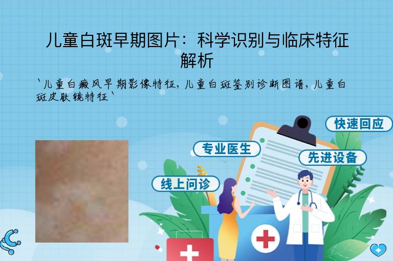 儿童白斑早期图片：科学识别与临床特征解析