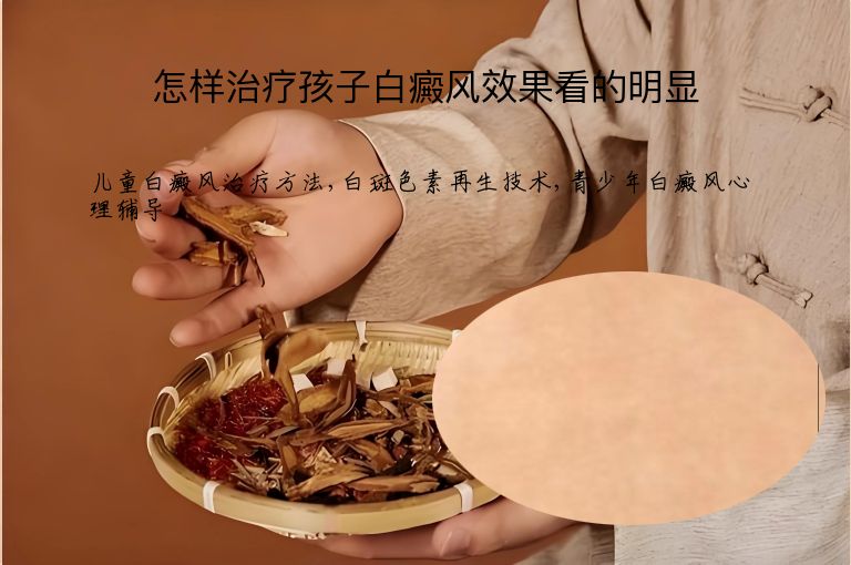 怎样治疗孩子白癜风效果看的明显”