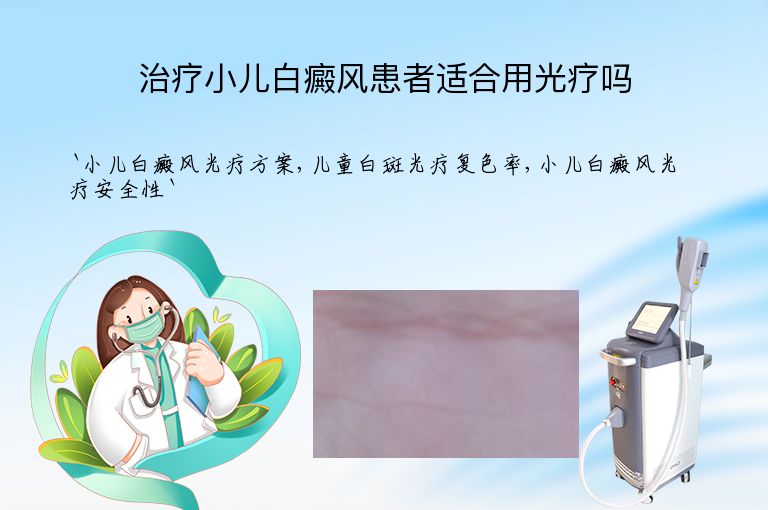 治疗小儿白癜风患者适合用光疗吗
