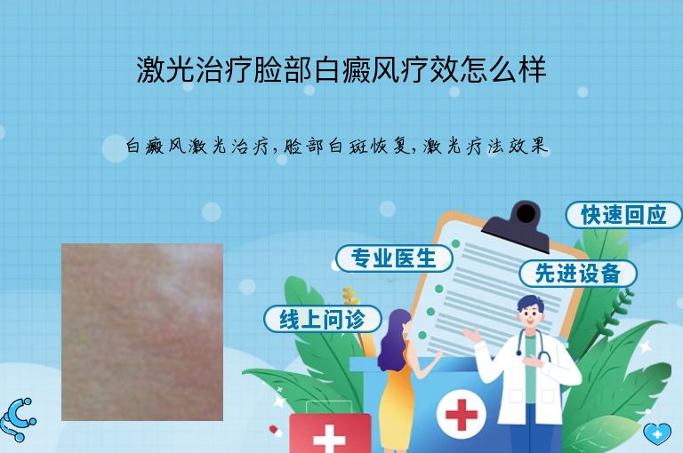 激光治疗脸部白癜风疗效怎么样”