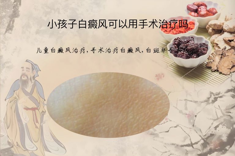 小孩子白癜风可以用手术治疗吗”