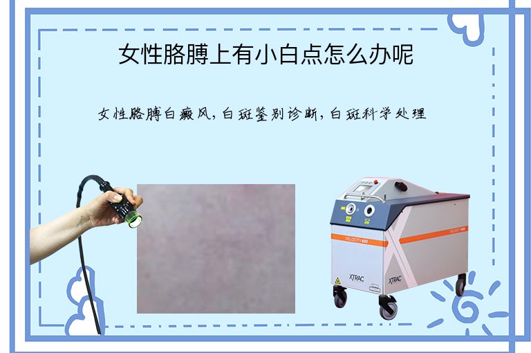 https://www.bdfsjzyy.com/d/file/p/d7dcfce75806f0944ad5cfd3b7b8088f.jpeg