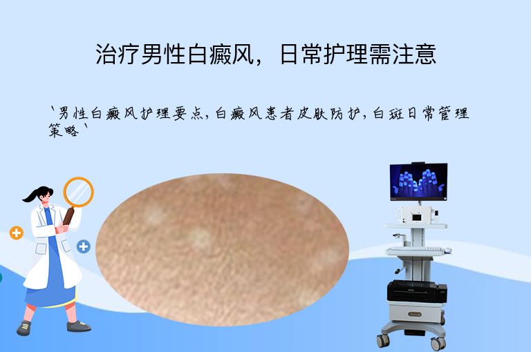 治疗男性白癜风,日常护理需注意