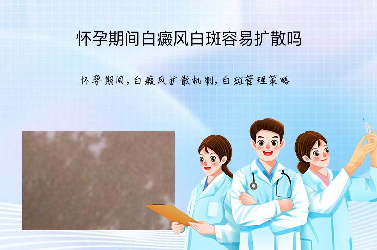 怀孕期间白癜风白斑容易扩散吗”