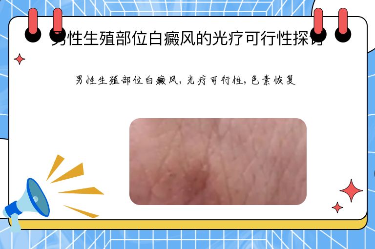 男性生殖部位白癜风的光疗可行性探讨”