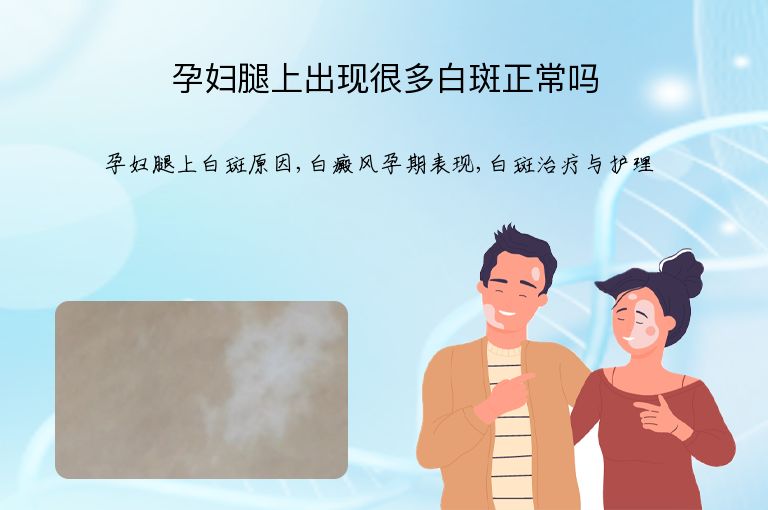 孕妇腿上出现很多白斑正常吗”