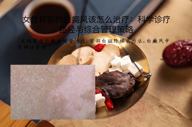 女性背部的白癜风该怎么治疗：科学诊疗路径与综合管理策略