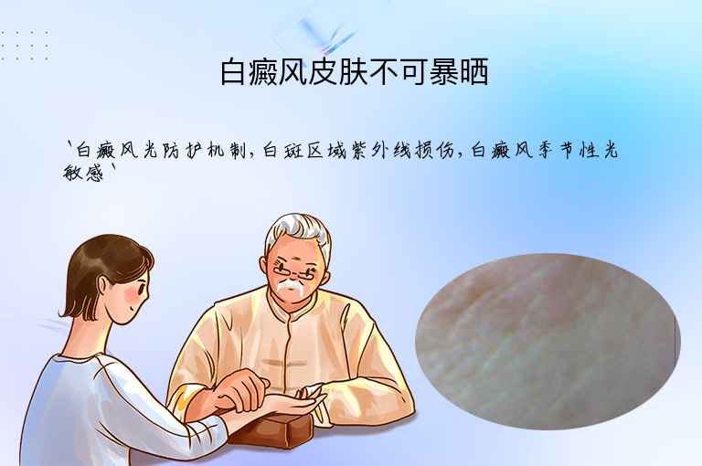 白癜风皮肤不可暴晒