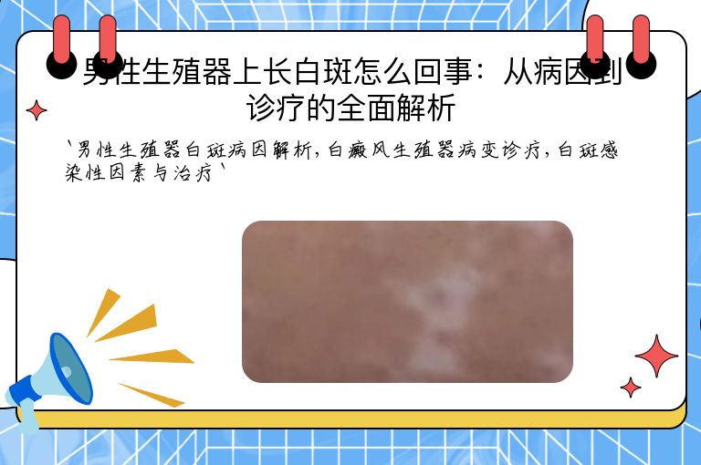 男性生殖器上长白斑怎么回事:从病因到诊疗的全面解析