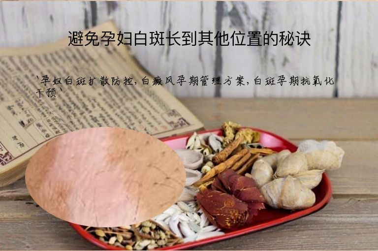 避免孕妇白斑长到其他位置的秘诀