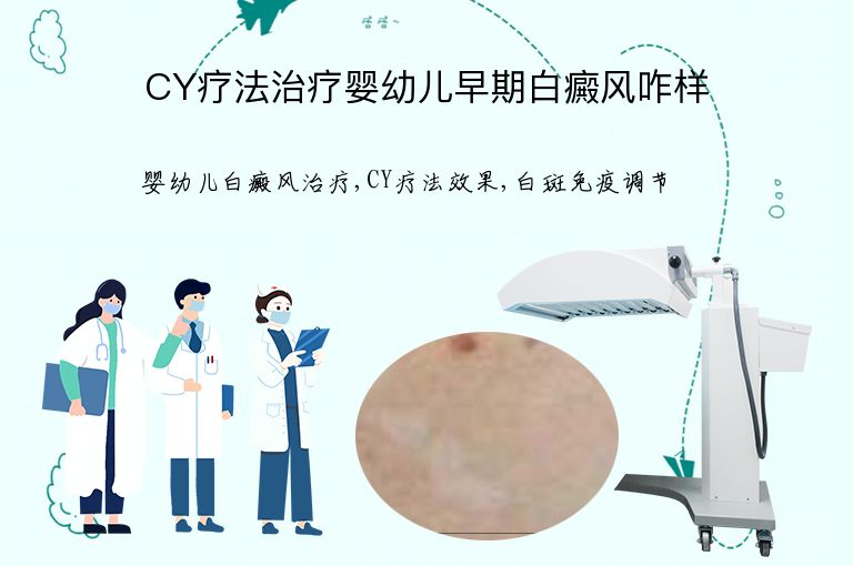 CY疗法治疗婴幼儿早期白癜风咋样”