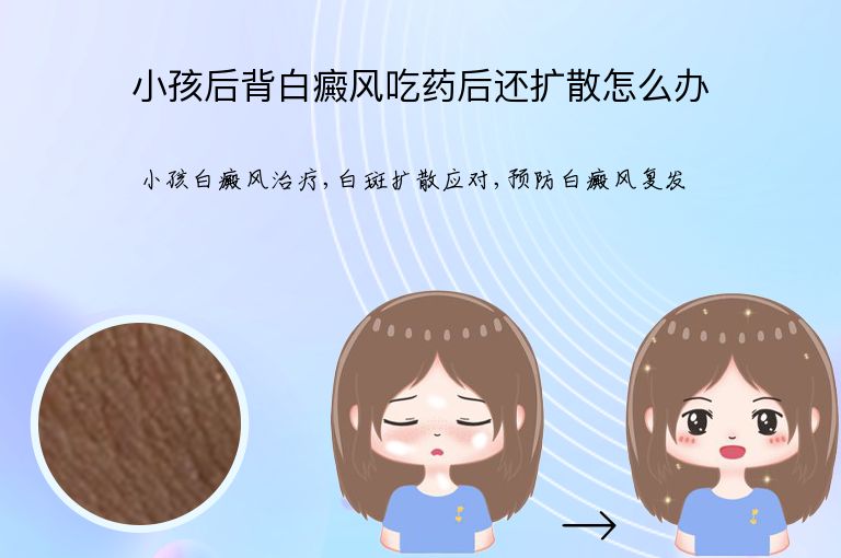 https://www.bdfsjzyy.com/d/file/p/c75b1647483883ff615921044bd84e9e.jpeg